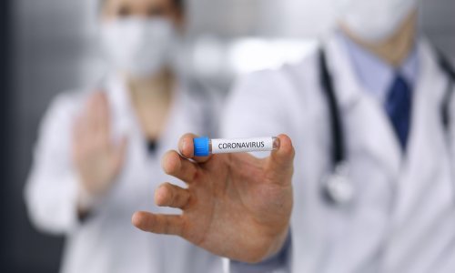 U Huaweiju razvijaju sustav za brže dijagnosticiranje koronavirusa temeljen na umjetnoj inteligenciji