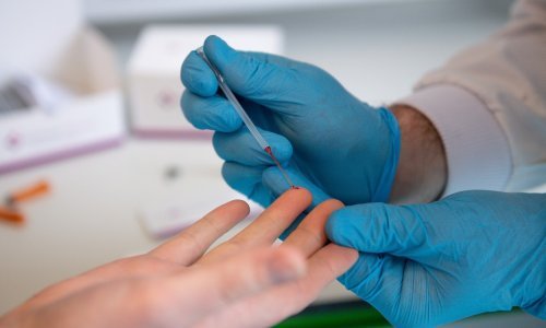 Britanci najavili prodaju osobnih testera na koronavirus: Moći će se kupovati u ljekarnama i preko Amazona, a to je tek početak...