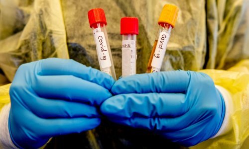 Zašto neke zemlje još uvijek imaju problema s testiranjem na koronavirus?