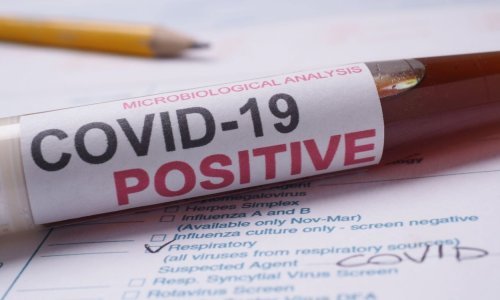 U SAD-u razvili i podijelili test za koronavirus s greškom