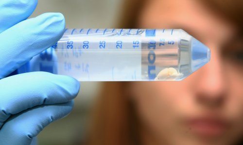 Raspisan natječaj za hrvatske znanstvenike u borbi protiv koronavirusa