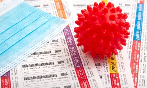 Priča se o uvođenju seroloških testova, doznajte koja je njihova uloga u borbi protiv koronavirusa