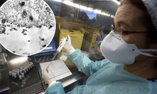 Znanstvenici usnimili trenutak u kojem koronavirus inficira stanicu. Pogledajte kako to izgleda