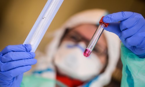 Znanstvenici koji su iznijeli uznemirujuće brojke o Njemačkoj upozoravaju: Svaka naočigled zdrava osoba može imati virus, a da to ni ne zna