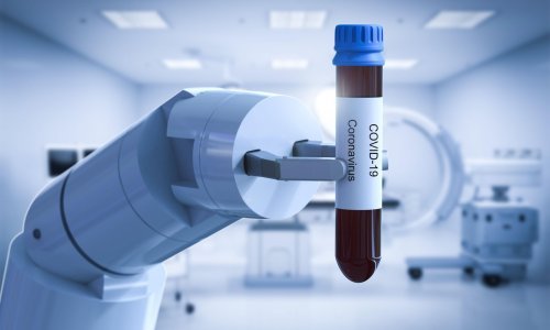 Roboti na prvoj crti bojišnice protiv koronavirusa: Mjere temperaturu, uzimaju brisove, održavaju red i rade na blagajnama