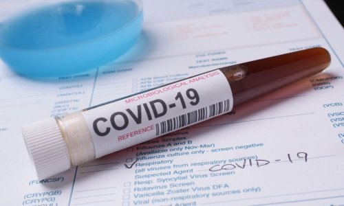 Ovo je prvi znak da bi cjepiva koja se razvijaju za koronavirus mogla biti učinkovita