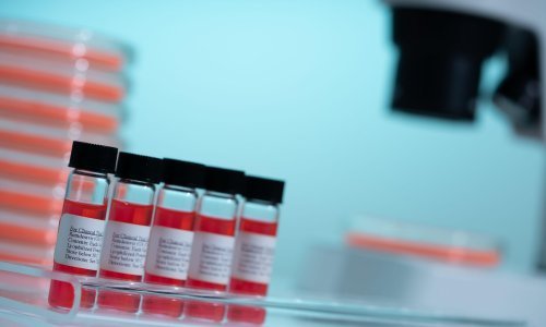 Osam cjepiva je u fazi kliničkog ispitivanja, EU razmatra mogućnost da dio sredstava iz kriznog fonda usmjeri u proizvodnju