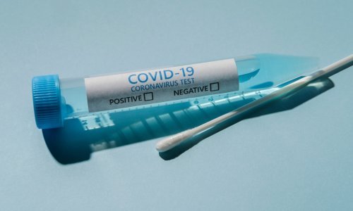 Sjedinjene Države odobrile prvi kućni test sline za covid-19