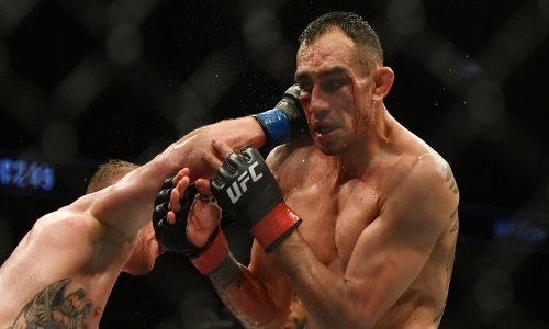 Tonyju Fergusonu teške batine nisu ubile duh veseljaka; objavio video iz bolnice u kojem pleše, a pokazao i kako mu izgleda lice