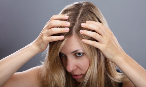 Patite li i vi od ovog neugodnog problema? Evo kako se uspješno riješiti dosadne prhuti