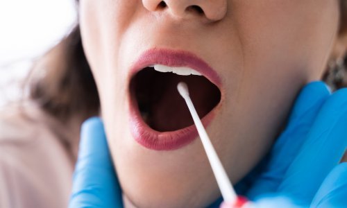 Znaju li ljudi sami sebi uzeti bris i koliko su uopće precizni rezultati kućnih testova na koronavirus?