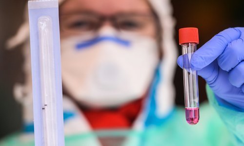 Liječnički zbor traži proširenje popisa pretraga za koje se pacijenti trebaju testirati na koronu