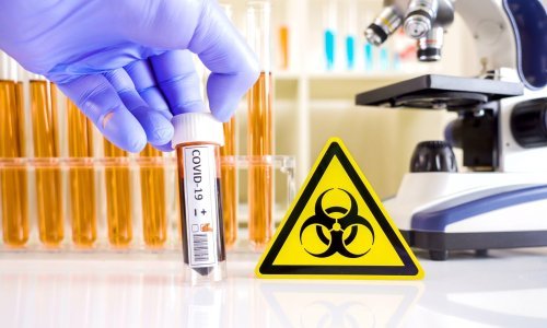 Kombinacija hidroksiklorokina opasna za oboljele od karcinoma i Covid-19