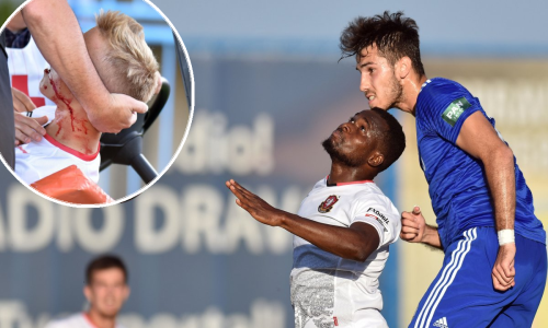 U Koprivnici bez golova; utakmicu obilježila teška ozljeda igrača Gorice te situacija u kojoj je suigrač 'ukrao' Krstanoviću pogodak