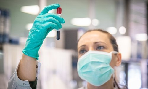 Znanstvenici traže odgovore: Zašto su neki u pandemiji prošli bolje od drugih i koliko je ljudi otporno na COVID-19