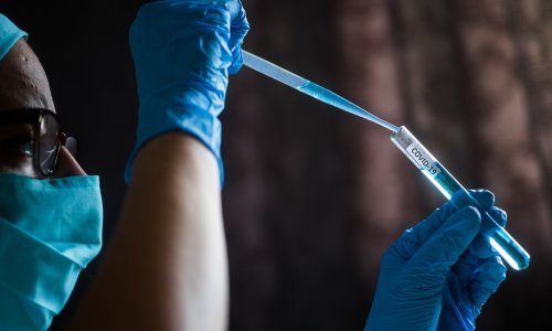 Novi test koronavirus otkriva za pola sata, analizator daha za 15 sekundi, a dresirani psi ga nanjuše i za manje od sekunde