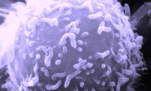 Nov pristup rak pretvara u bezopasnu bolest!?