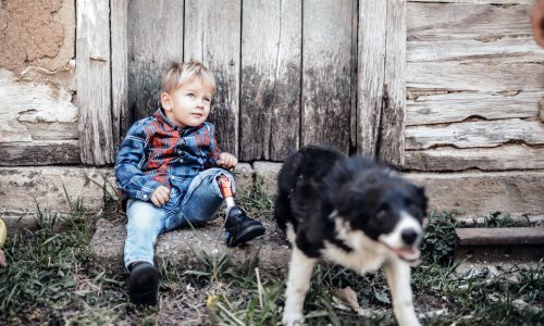 Dječaka rođenog s teškim fizičkim deformacijama odbili primiti u vrtić