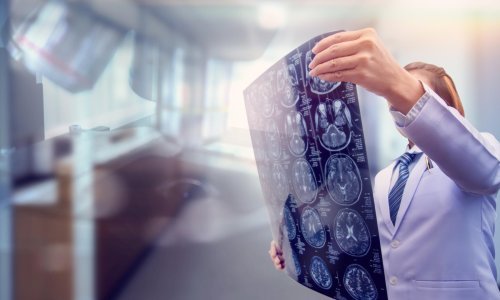 Britanci otkrivaju: Koronavirus može uzrokovati opasne neurološke probleme, od delirija i upale mozga do moždanog udara