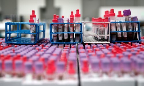 Virovitičko-podravska županija nabavlja PCR uređaj za brže otkrivanje covida-19