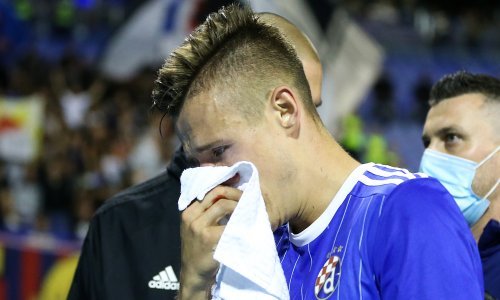 [FOTO] Dinamova zvijezda koja je nastradala u derbiju objavila fotografiju lica poslije operacije, ali i tužnu vijest