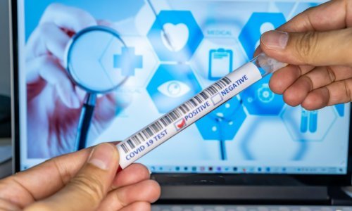 Ovo su nevjerojatne nove tehnologije za testiranje na COVID-19 koje skraćuju vrijeme čekanja na rezultate
