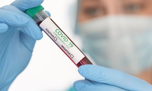 Što ako je test na Covid-19 nevažeći?