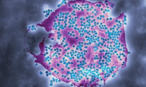 Uspjeh znanstvenika: Otkrili kako virus manipulira stanicama da bi se replicirao
