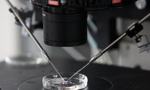 Nizozemski ginekolog oplodio pacijentice bez njihova znanja