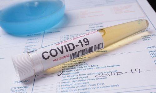 Odgojiteljica u dječjem vrtiću u Dubrovniku pozitivna na koronavirus