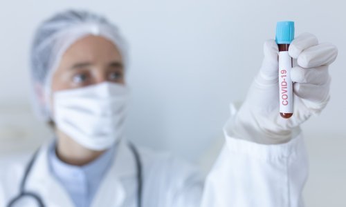 Znanstvenici zbunjeni: Žena prenosila koronavirus 70 dana, a nikad nije pokazivala nikakve simptome