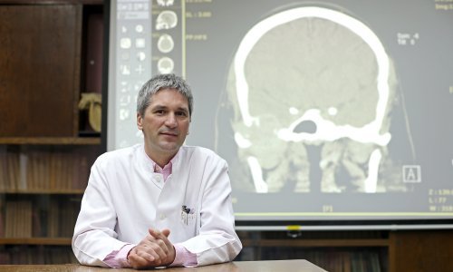 U KB-u Dubrava napravljeno 80 operacija na Covid-19 pozitivnim pacijentima