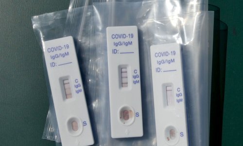 Testiranje na antitijela pokazuje manji broj zaraženih koronavirusom