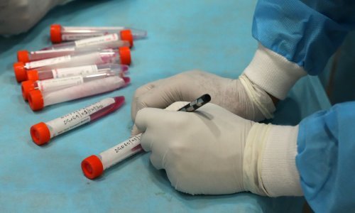 Uhićene dvije žene zbog krivotvorenja testova na koronavirus