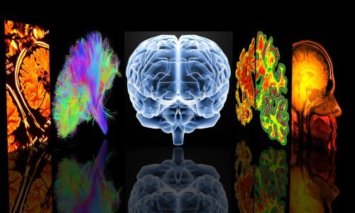 Neurološke komplikacije zbog Covida-19 česte su čak i u umjerenim slučajevima bolesti