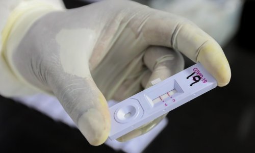 Stigli prvi rezultati masovnog testiranja u pogonima na sjeveru Hrvatske