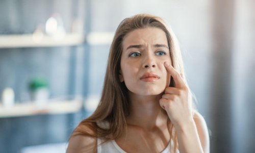 Pojavio vam se dosadni prištić? Možda će vam pomoći ovi korisni savjeti za prikrivanje