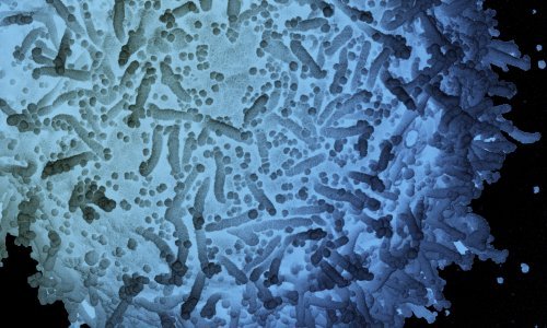 Stručnjaci Svjetske zdravstvene organizacije dolaze u Kinu 14. siječnja otkriti porijeklo koronavirusa