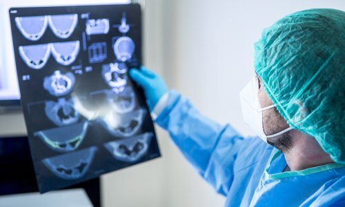 Mikroinfarkti, moždani udari, stanična smrt... Koronavirus može zaraziti stanice mozga i uzrokovati teška oštećenja moždanog tkiva