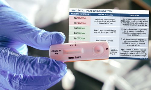 Mislite da ste 'prehodali' koronu i htjeli biste se testirati? Otkrivamo sve o serološkim testovima, gdje se mogu obaviti i koliko koštaju