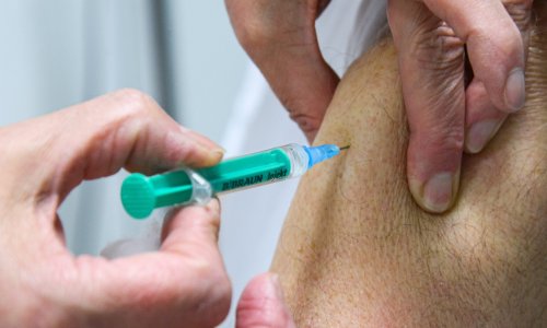 Farmaceutkinja iz Beograda koja se cijepila Sputnjikom V opisala nuspojave: Prva doza ništa, a nakon druge su me boljeli i kapci, ali je brzo prošlo