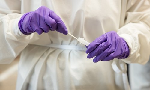 Slovenskom liječniku potvrđena reinfekcija koronavirusom unatoč cijepljenju