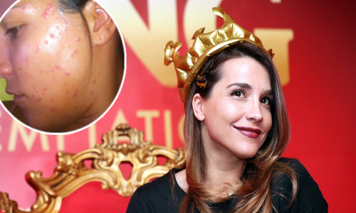 Marijana Batinić iznenadila fotografijom iz mladosti i progovorila o mukotrpnoj borbi s problemom koji muči mnoge