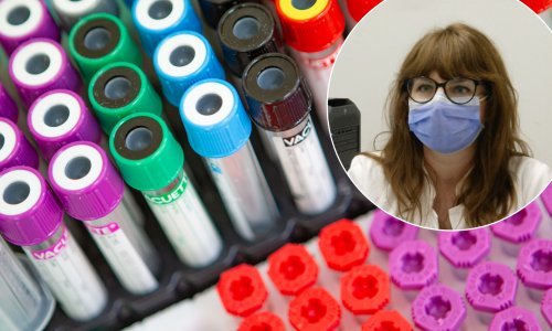 Cijepili ste se i želite znati imate li i koliko protutijela? Stručnjakinja otkriva sve o testovima, ali i upozorava: Ako imate protutijela, to ne znači da ste zaštićeni