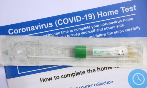 Kućni test za koronu u Hrvatskoj košta 80, a u Njemačkoj 22 kune. Objašnjenje veledrogerije za razliku u cijeni je zanimljivo