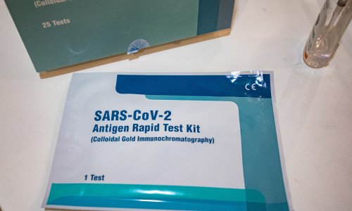 Zagreb ukinuo besplatno testiranje na koronu brzim antigenskim testovima