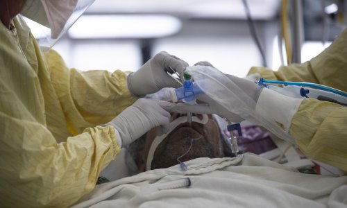 Stiglo novo izvješće o radu bolnica: Liječeno 20 posto manje pacijenata, a potrošeno 500 milijuna kuna više