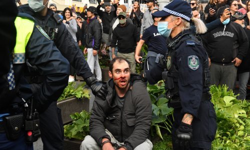 Razbijene glave na prosvjedima protiv korona-mjera u Australiji