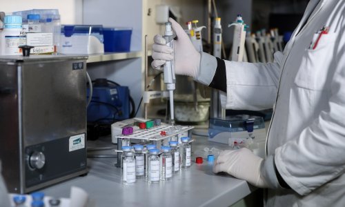 Švicarski imunolog: COVID-22 bi mogao biti gori od svega što smo do sad iskusili