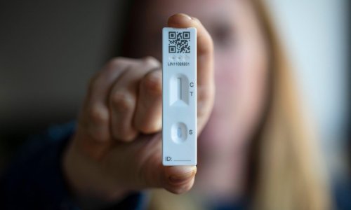 Slovenske učenike čekaju kompleti za samotestiranje, obavljat će ga jednom tjedno